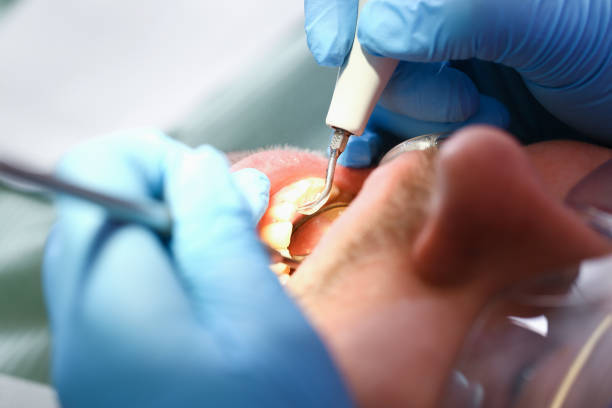 Best Emergency Dentist for Knocked-Out Tooth in Coal Valley, IL